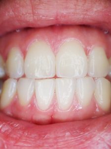 Healthy gums from gum disease treatment in Centreville, VA