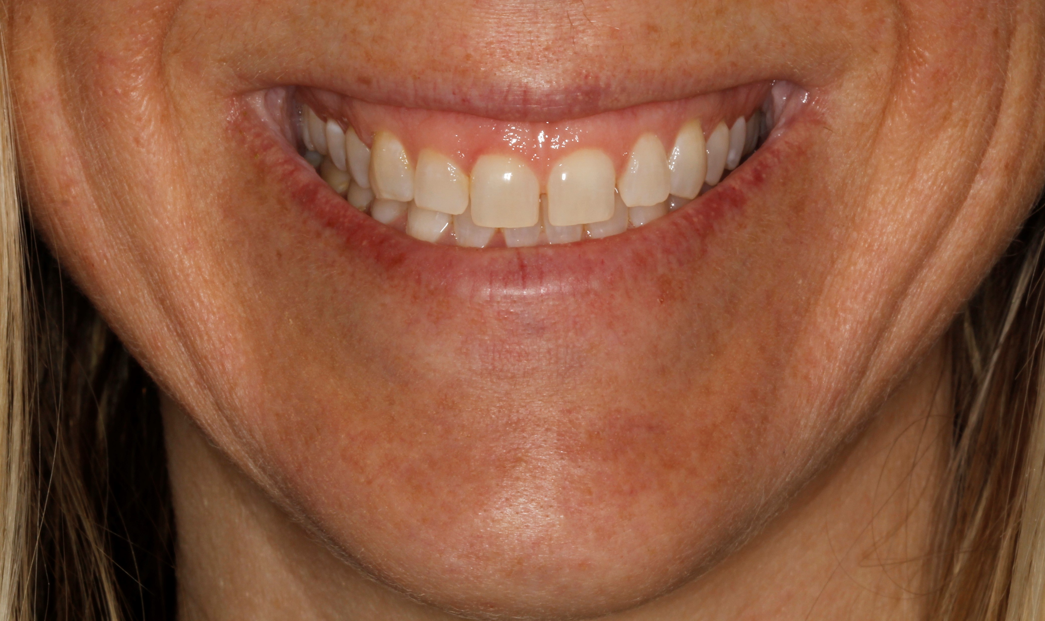 close up teeth together Centreville Dental Wellness Center
