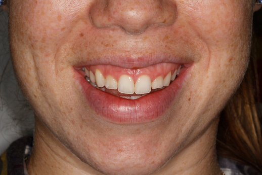 Before image