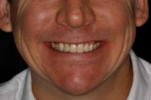 Before image