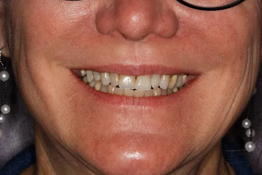 Before image